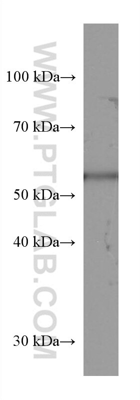 SLC2A9