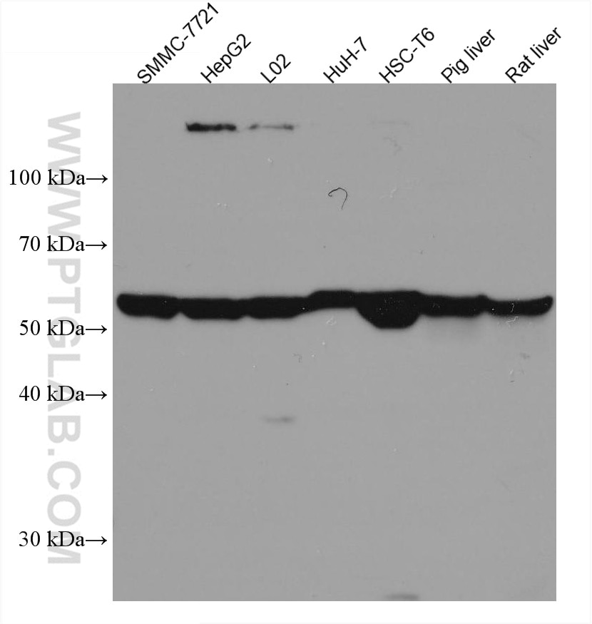 Western Blot (WB) analysis of various lysates using SLC2A9 Monoclonal antibody (67530-1-Ig)