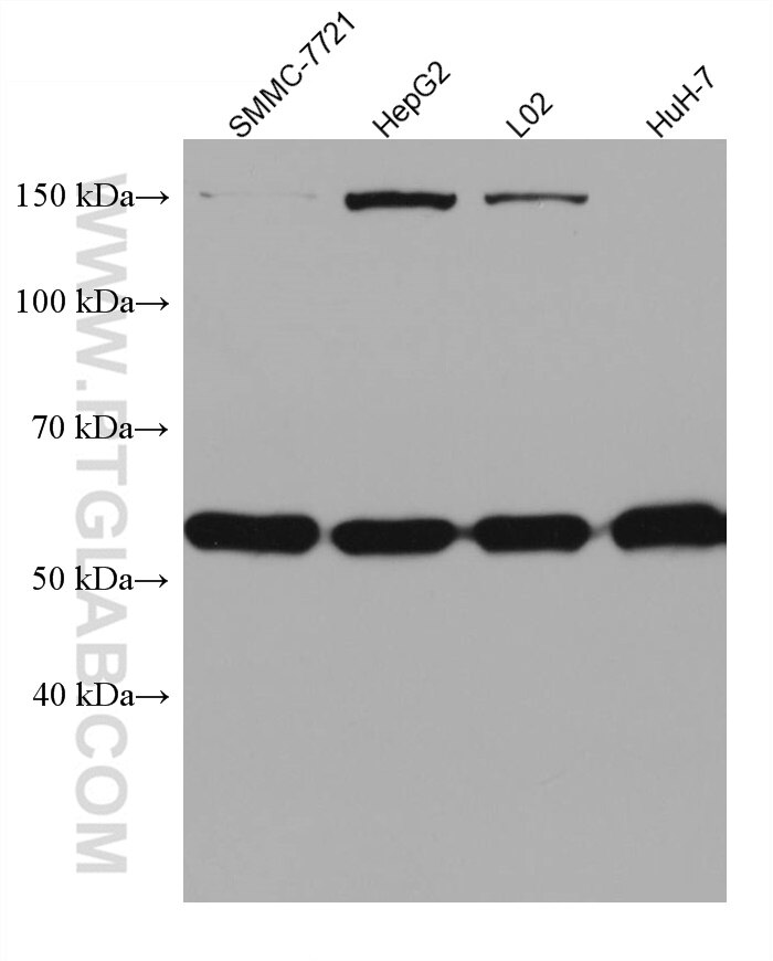 Western Blot (WB) analysis of various lysates using SLC2A9 Monoclonal antibody (67530-1-Ig)