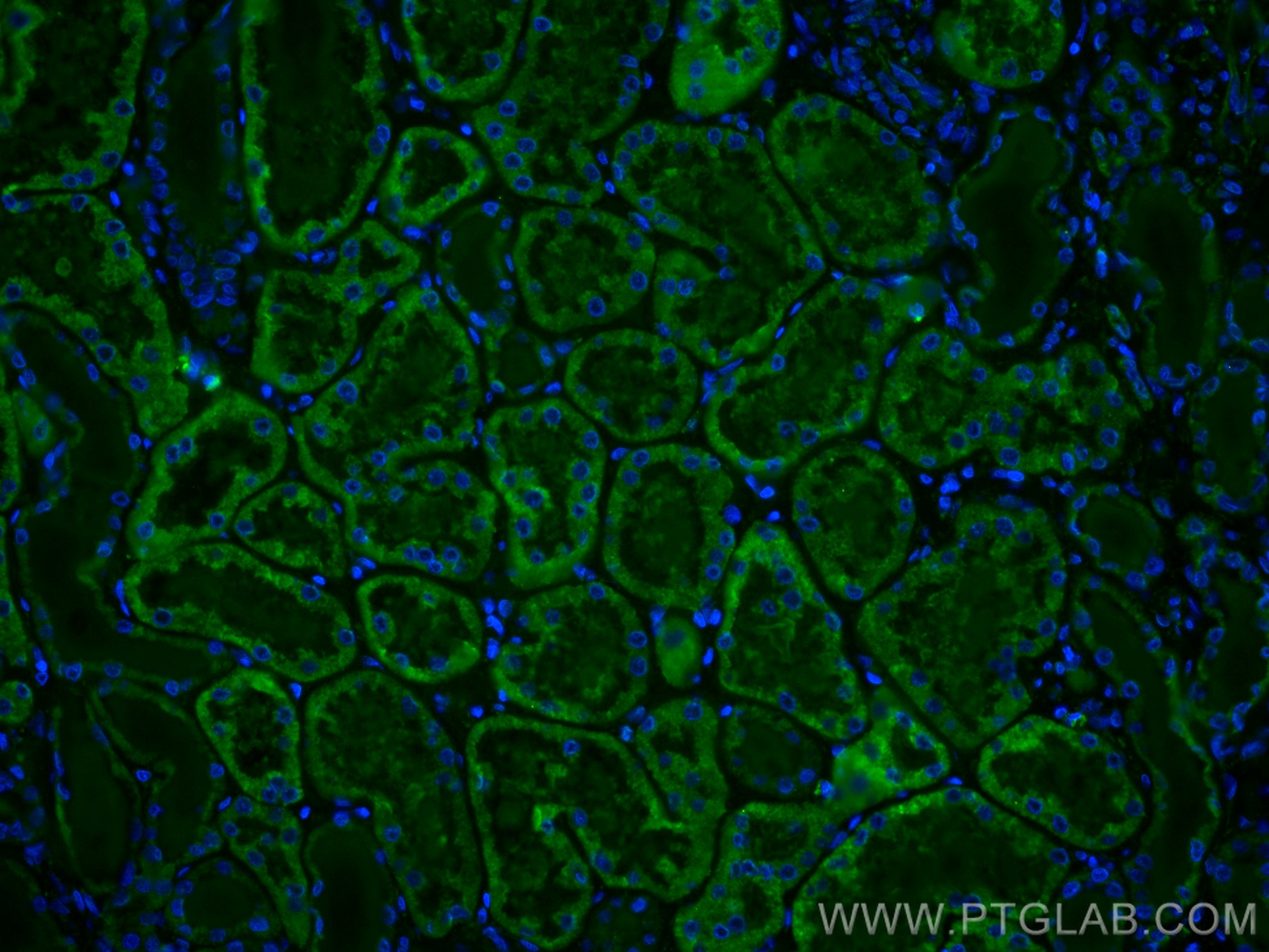 Immunofluorescence (IF) / fluorescent staining of human kidney tissue using CoraLite® Plus 488-conjugated SLC2A9 Monoclonal an (CL488-67530)