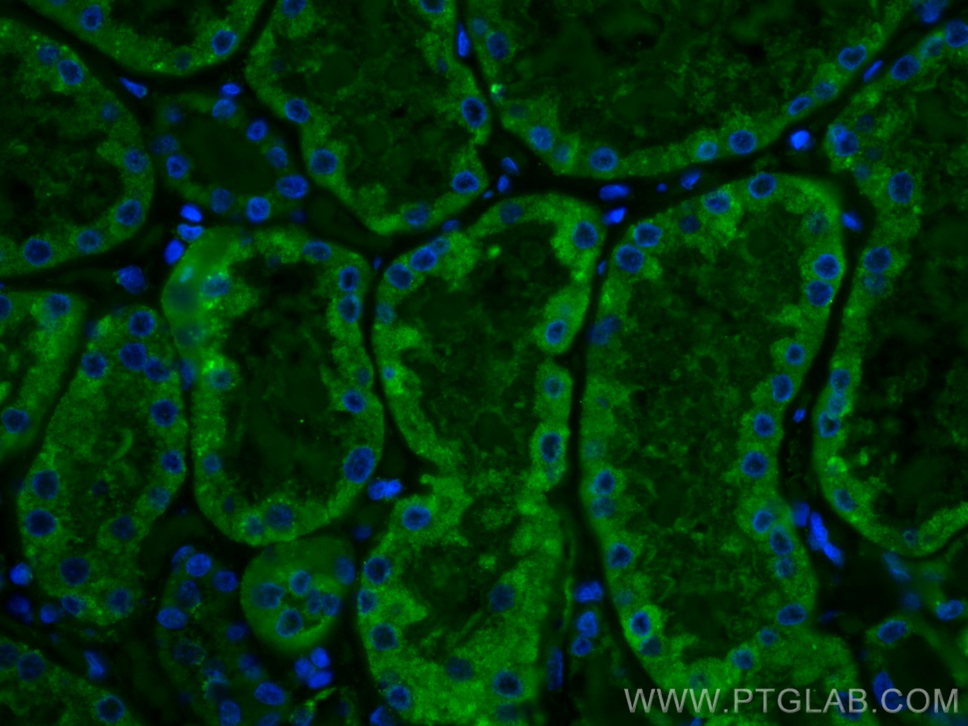 Immunofluorescence (IF) / fluorescent staining of human kidney tissue using CoraLite® Plus 488-conjugated SLC2A9 Monoclonal an (CL488-67530)