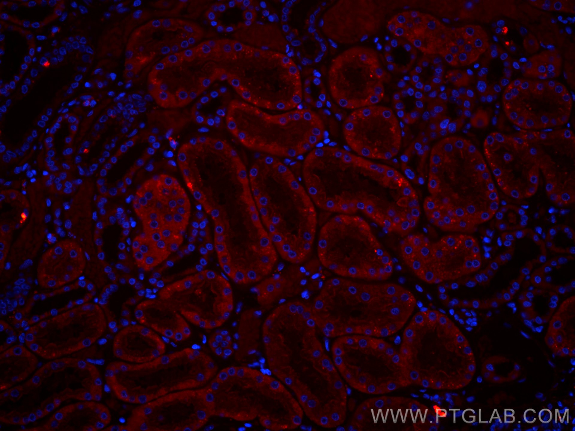 IF Staining of human kidney using CL594-67530