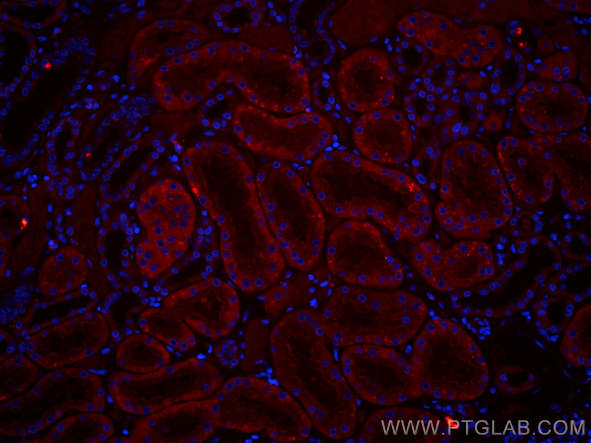 Immunofluorescence (IF) / fluorescent staining of human kidney tissue using CoraLite®594-conjugated SLC2A9 Monoclonal antibody (CL594-67530)