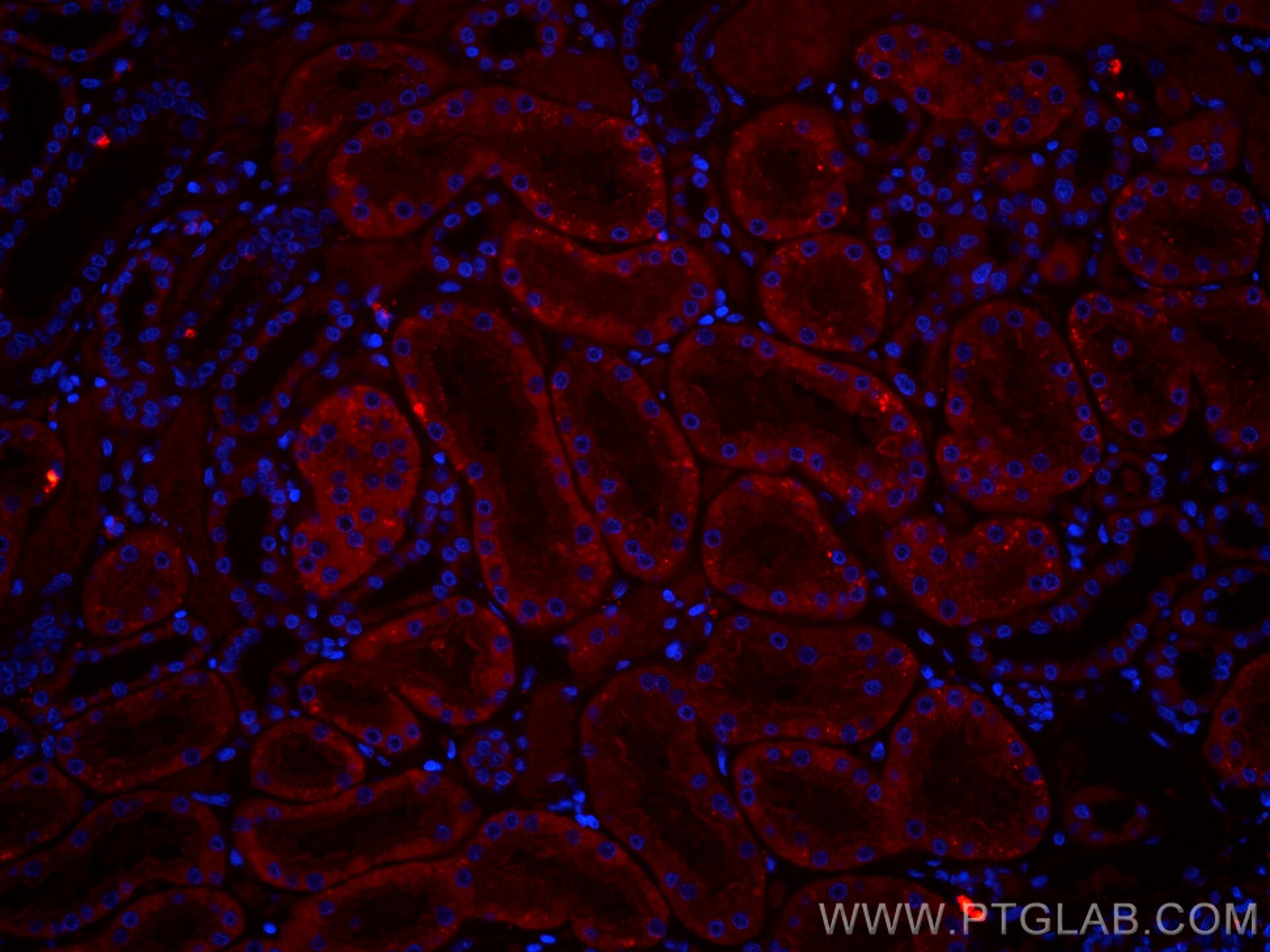 Immunofluorescence (IF) / fluorescent staining of human kidney tissue using CoraLite®594-conjugated SLC2A9 Monoclonal antibody (CL594-67530)