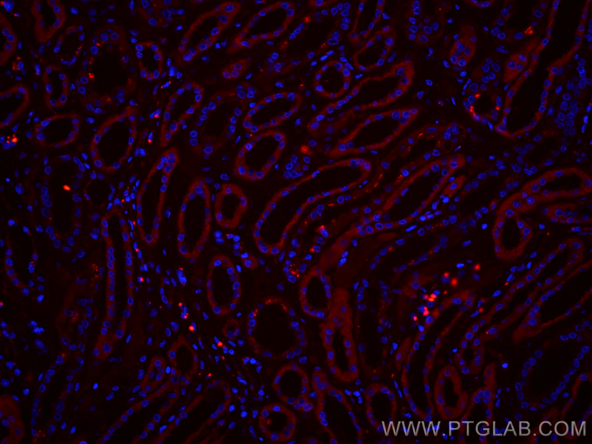 Immunofluorescence (IF) / fluorescent staining of human kidney tissue using CoraLite®594-conjugated SLC2A9 Monoclonal antibody (CL594-67530)