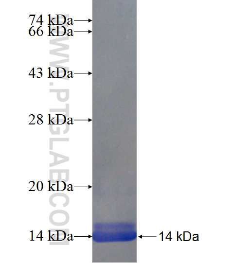 SLC2A9 fusion protein Ag24135 SDS-PAGE