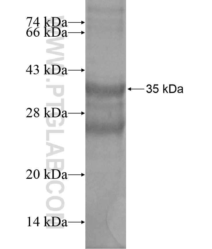 SLC2A9 fusion protein Ag18480 SDS-PAGE