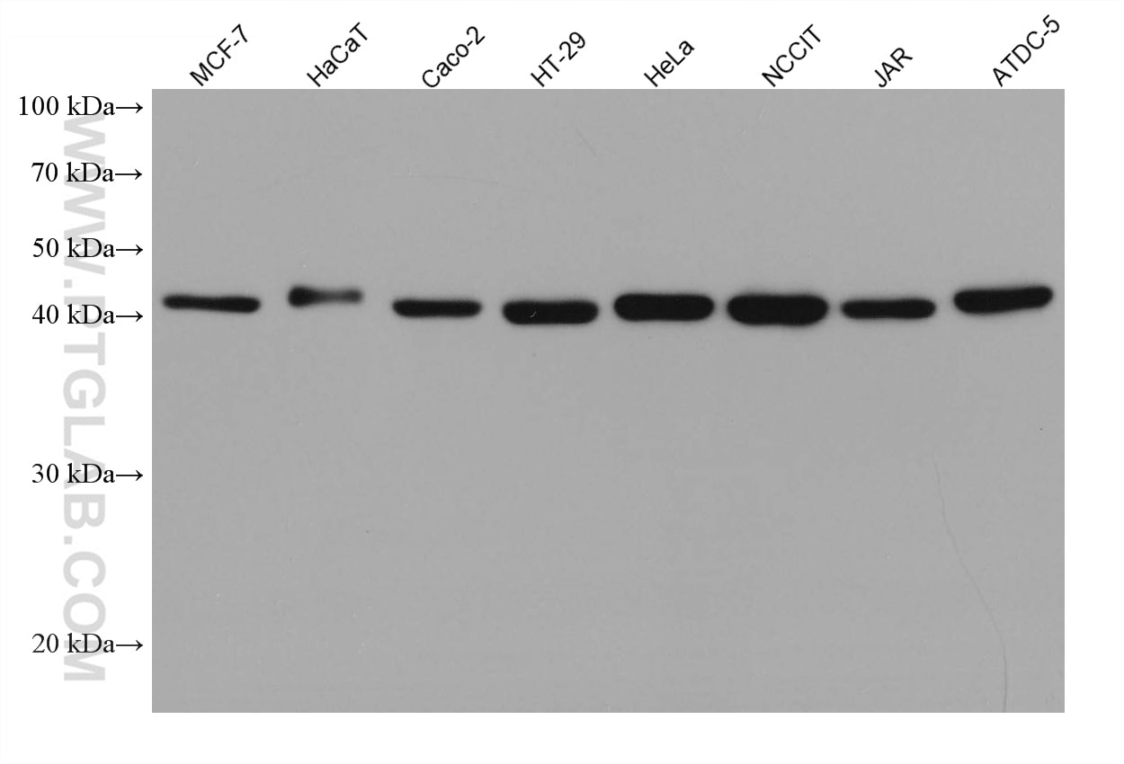 Western Blot (WB) analysis of various lysates using SLC30A2 Monoclonal antibody (67993-1-Ig)