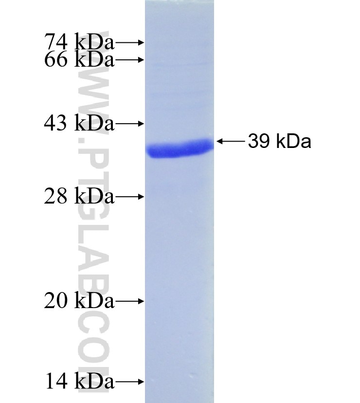 SLC30A2 fusion protein Ag8138 SDS-PAGE