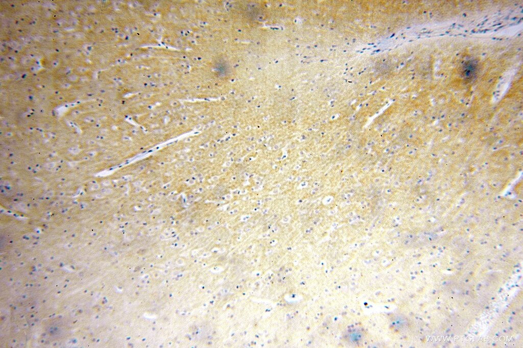 Immunohistochemistry (IHC) staining of human brain tissue using ZnT3 Polyclonal antibody (17363-1-AP)