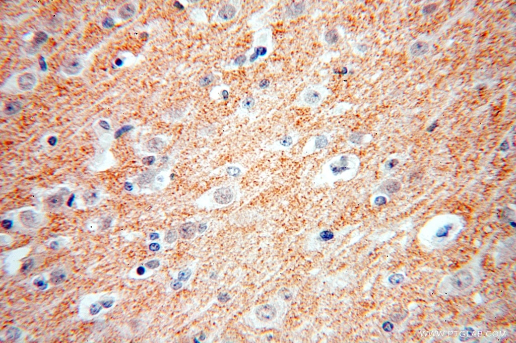 Immunohistochemistry (IHC) staining of human brain tissue using ZnT3 Polyclonal antibody (17363-1-AP)