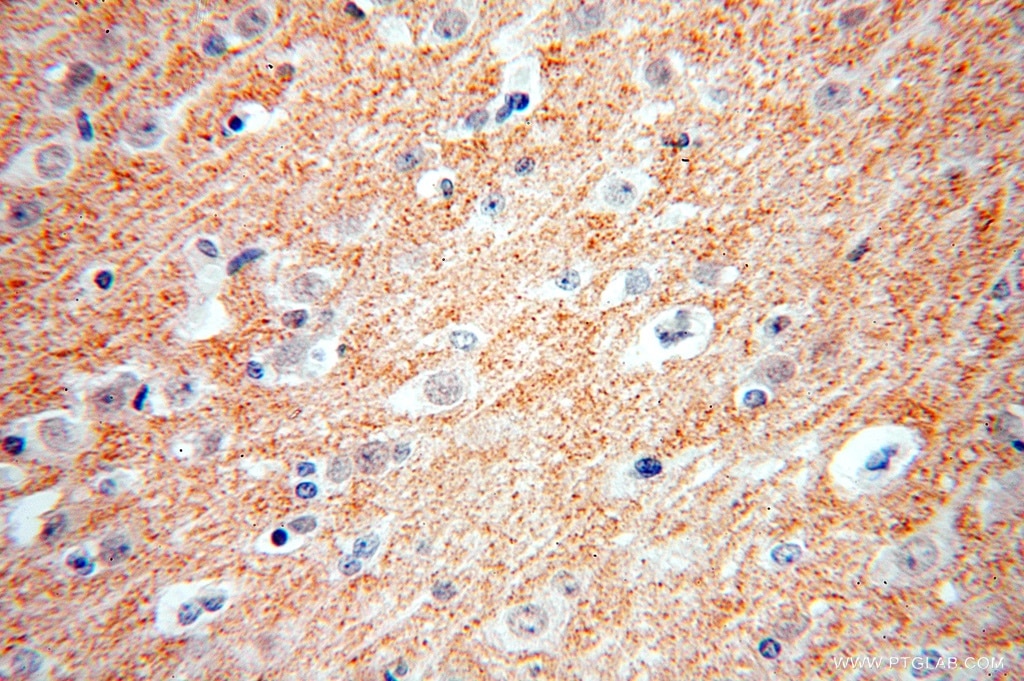 ZnT3 Polyclonal antibody