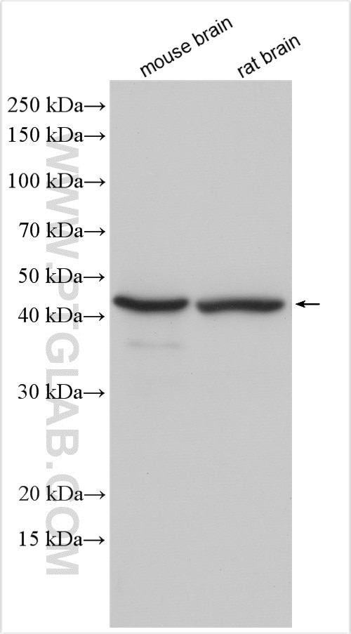 Western Blot (WB) analysis of various lysates using ZnT3 Polyclonal antibody (17363-1-AP)