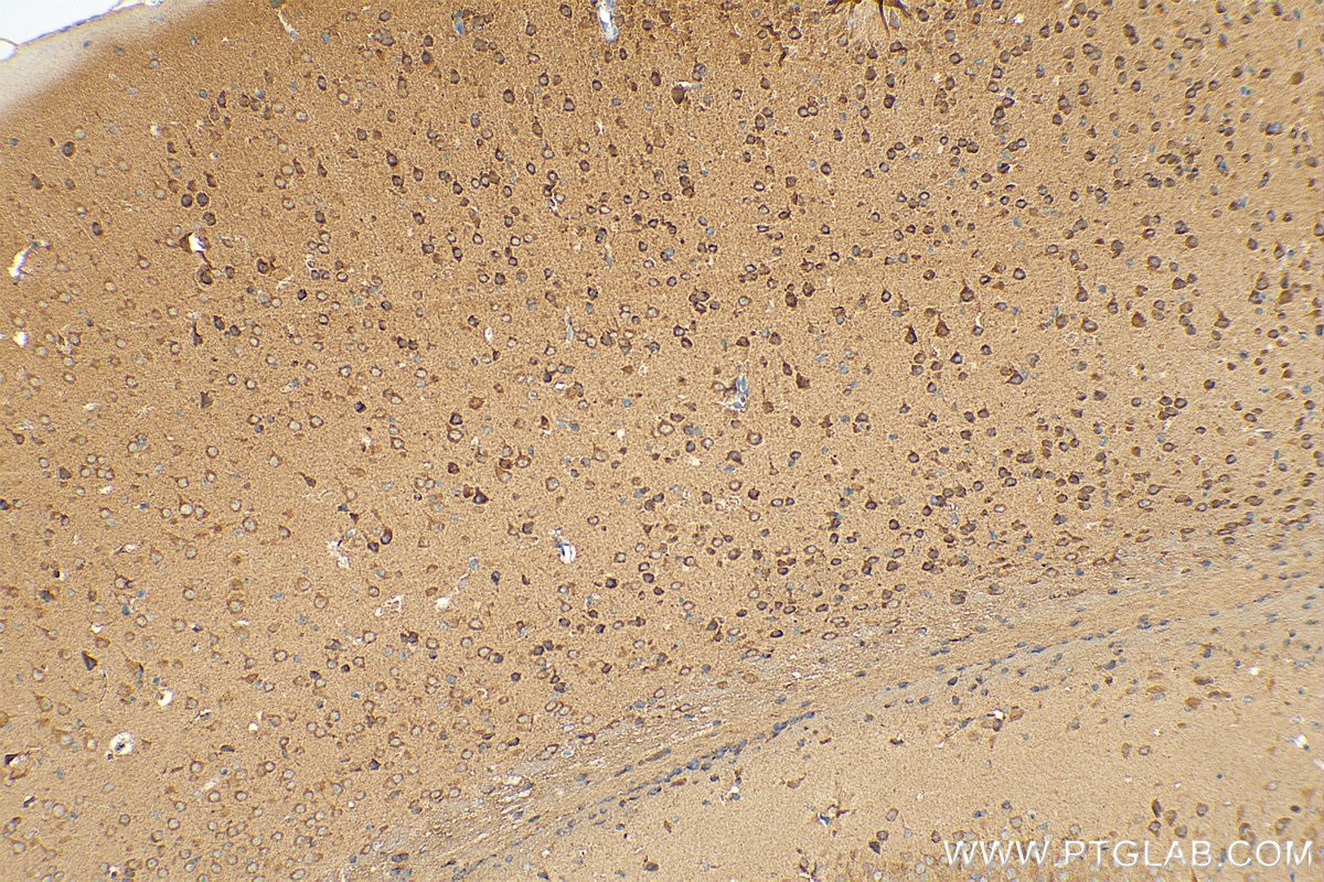 Immunohistochemistry (IHC) staining of mouse brain tissue using ZNT4 Polyclonal antibody (12623-1-AP)