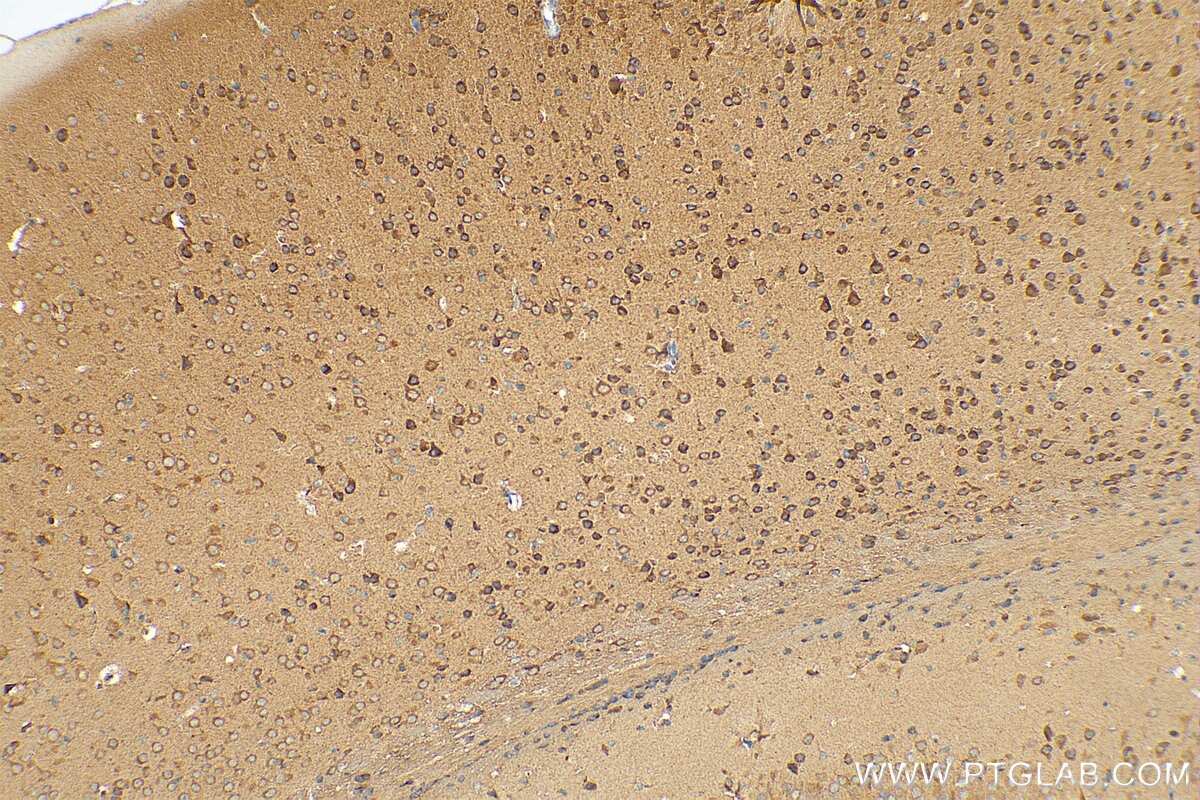 Immunohistochemistry (IHC) staining of mouse brain tissue using ZNT4 Polyclonal antibody (12623-1-AP)