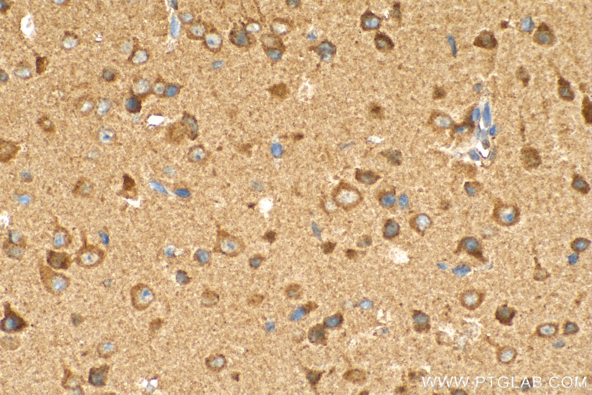 Immunohistochemistry (IHC) staining of mouse brain tissue using ZNT4 Polyclonal antibody (12623-1-AP)