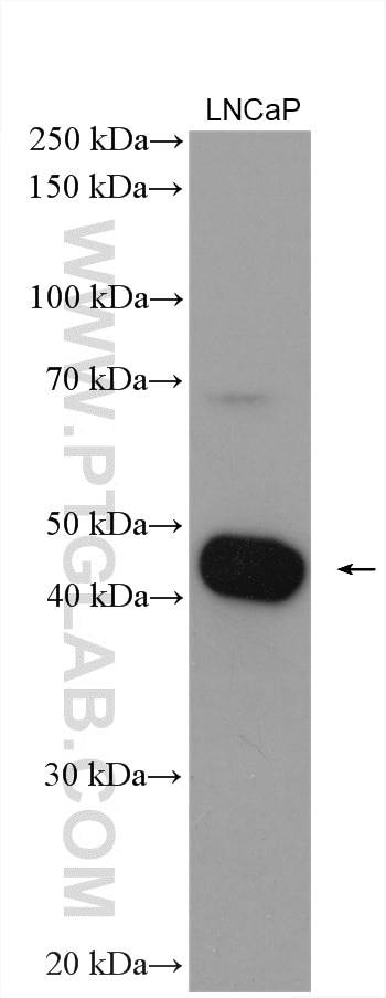 Western Blot (WB) analysis of various lysates using ZNT4 Polyclonal antibody (12623-1-AP)