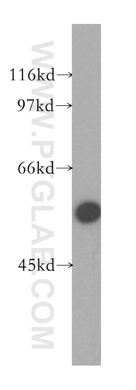 Western Blot (WB) analysis of A375 cells using ZnT6 Polyclonal antibody (13526-1-AP)