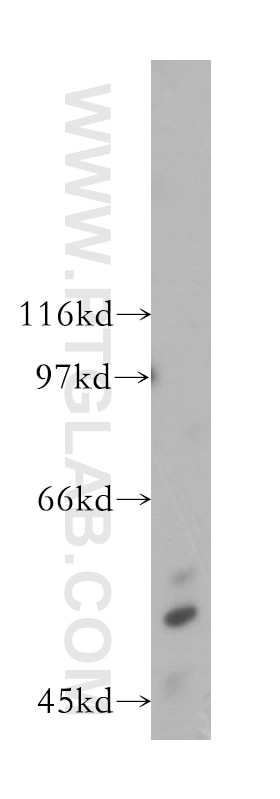 Western Blot (WB) analysis of K-562 cells using ZnT6 Polyclonal antibody (13526-1-AP)