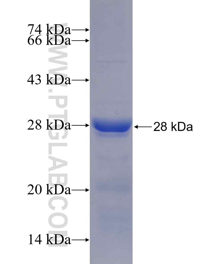 SLC30A6 fusion protein Ag5535 SDS-PAGE