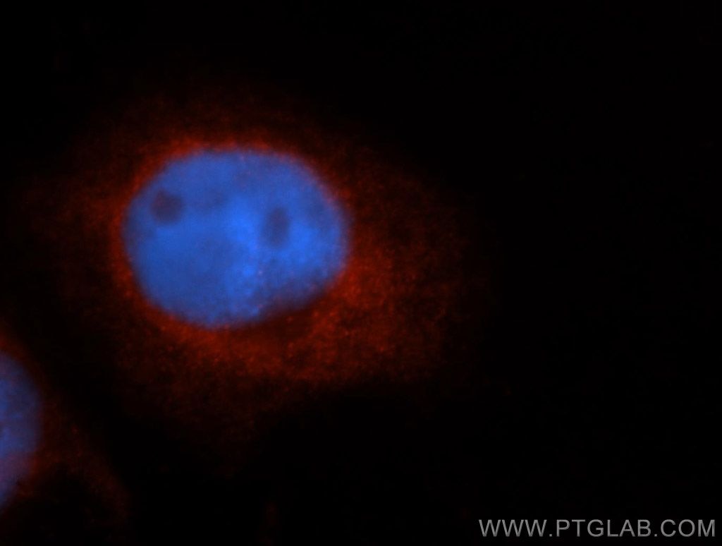 Immunofluorescence (IF) / fluorescent staining of A431 cells using ZnT7 Polyclonal antibody (13966-1-AP)
