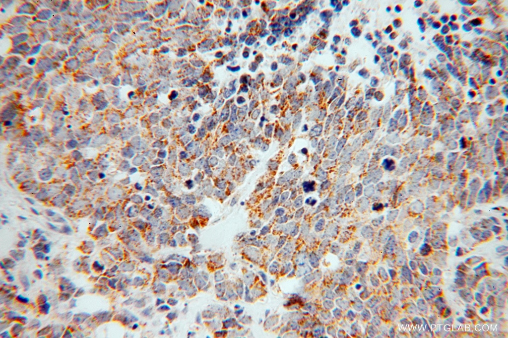 ZnT7 Polyclonal antibody