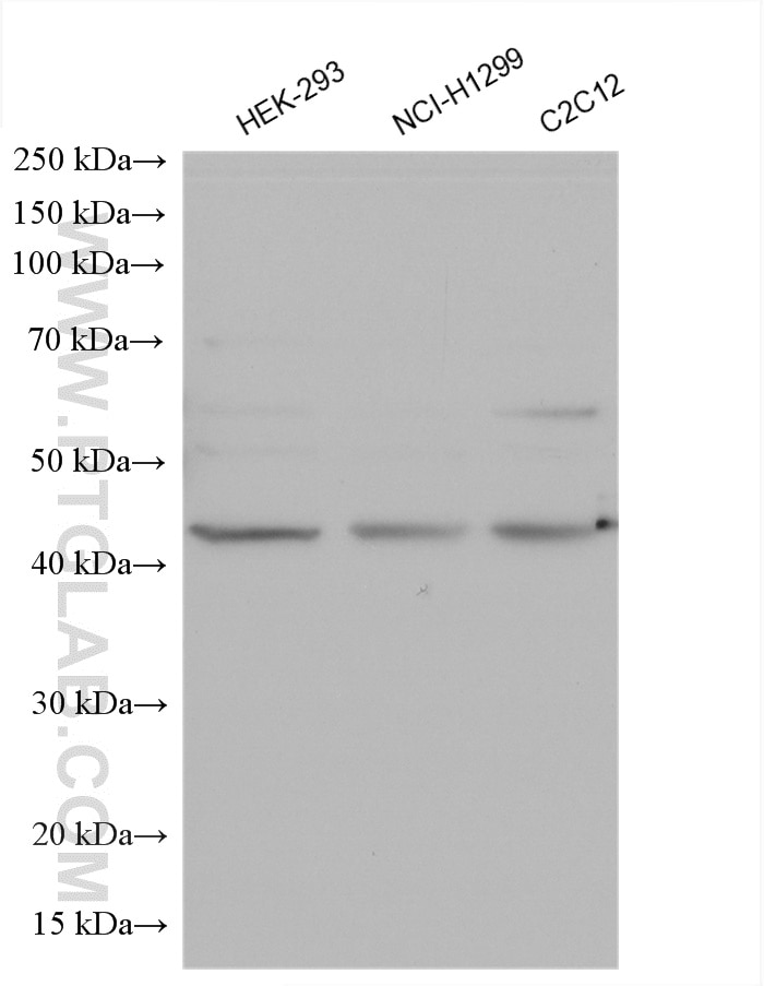 Western Blot (WB) analysis of various lysates using ZnT7 Polyclonal antibody (13966-1-AP)
