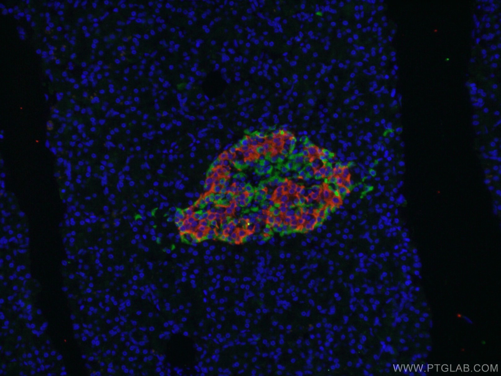 IF Staining of human pancreas using 16169-1-AP