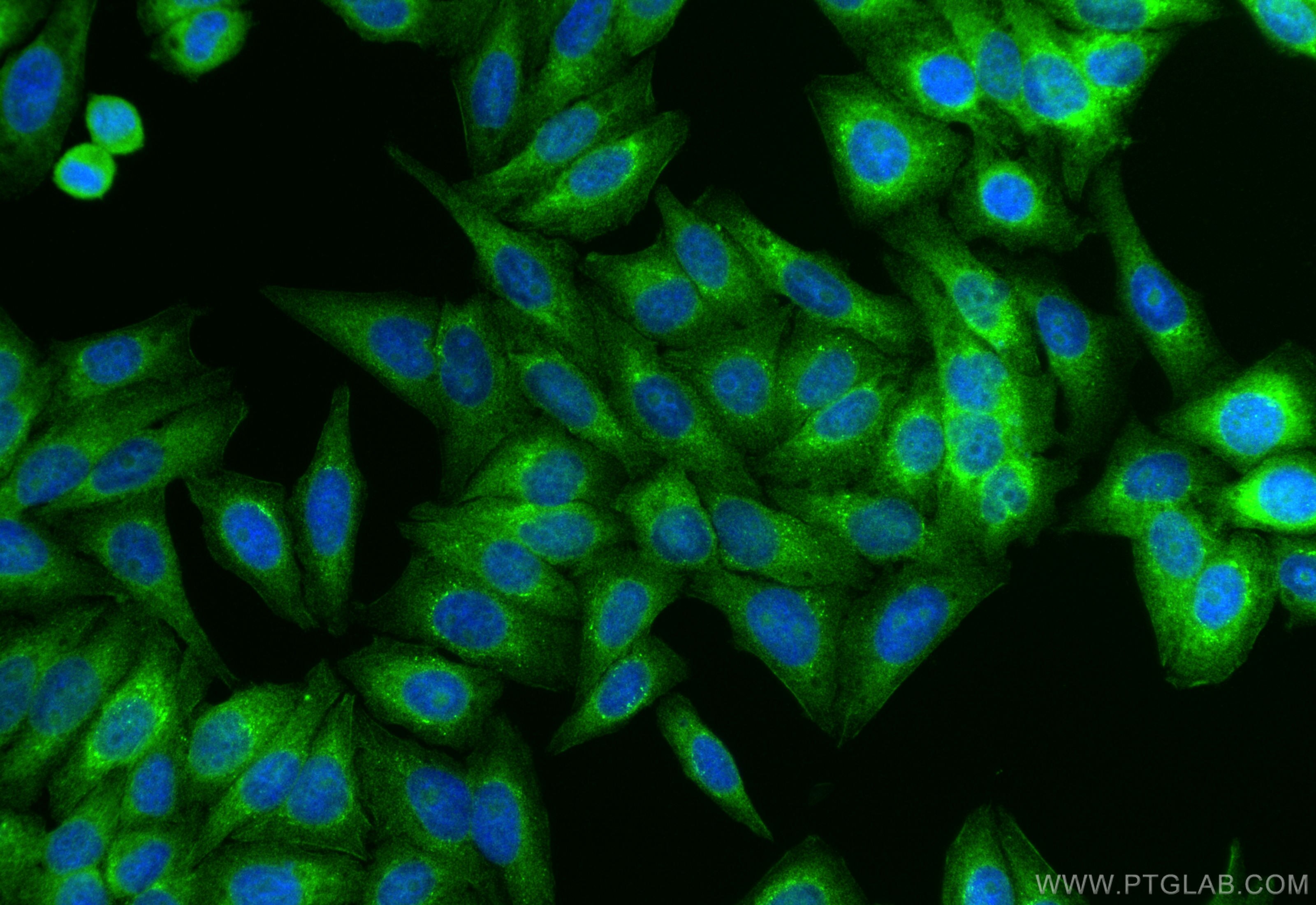 Immunofluorescence (IF) / fluorescent staining of HepG2 cells using SLC30A8/ZNT8-Specific Polyclonal antibody (16169-1-AP)