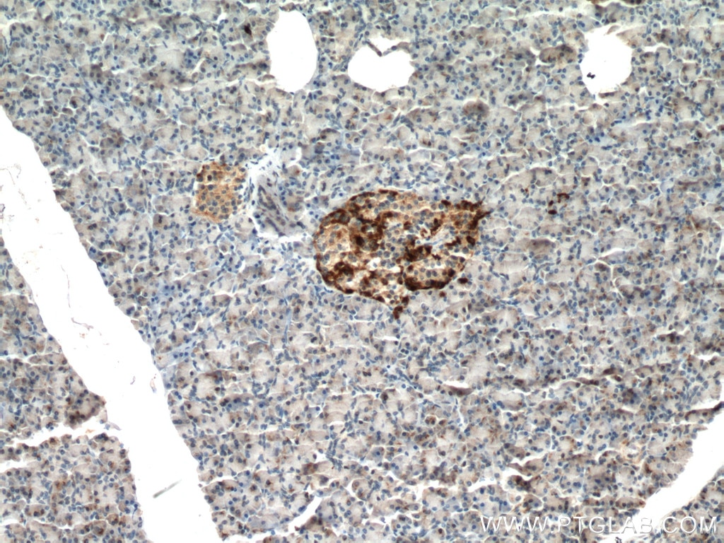 Immunohistochemistry (IHC) staining of human pancreas tissue using SLC30A8/ZNT8-Specific Polyclonal antibody (16169-1-AP)