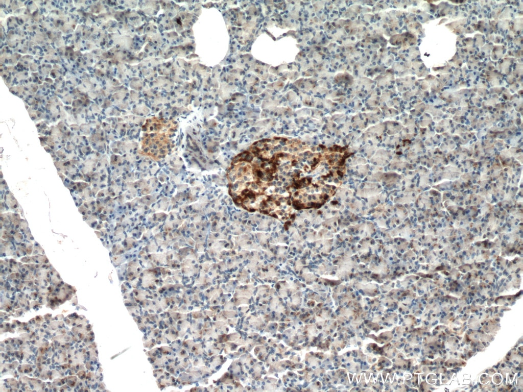 IHC staining of human pancreas using 16169-1-AP