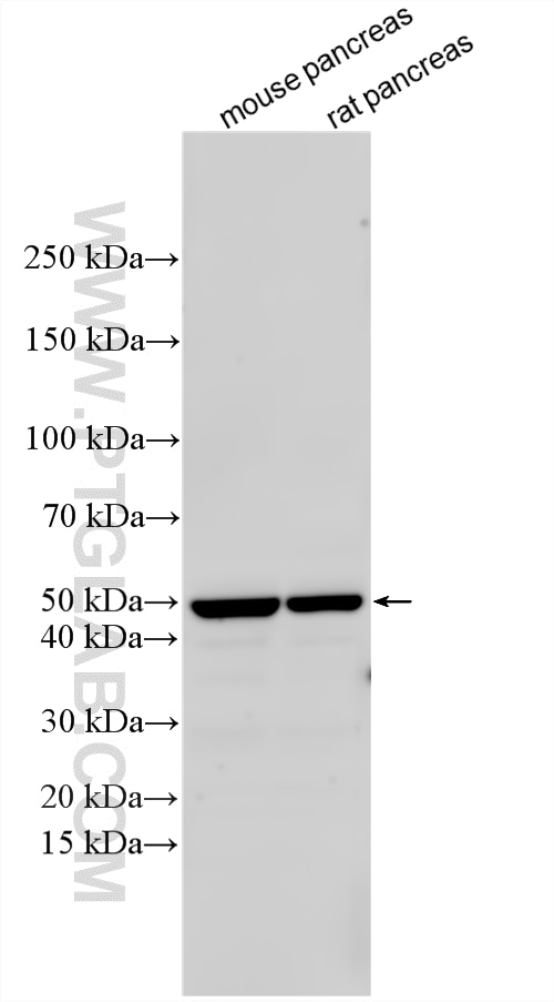 Various lysates were subjected to SDS PAGE followed by western blot with 16169-1-AP (SLC30A8/ZNT8-Specific antibody) at dilution of 1:1000 incubated at room temperature for 1.5 hours. Western Blot (WB) analysis of various lysates using SLC30A8/ZNT8-Specific Polyclonal antibody (16169-1-AP)