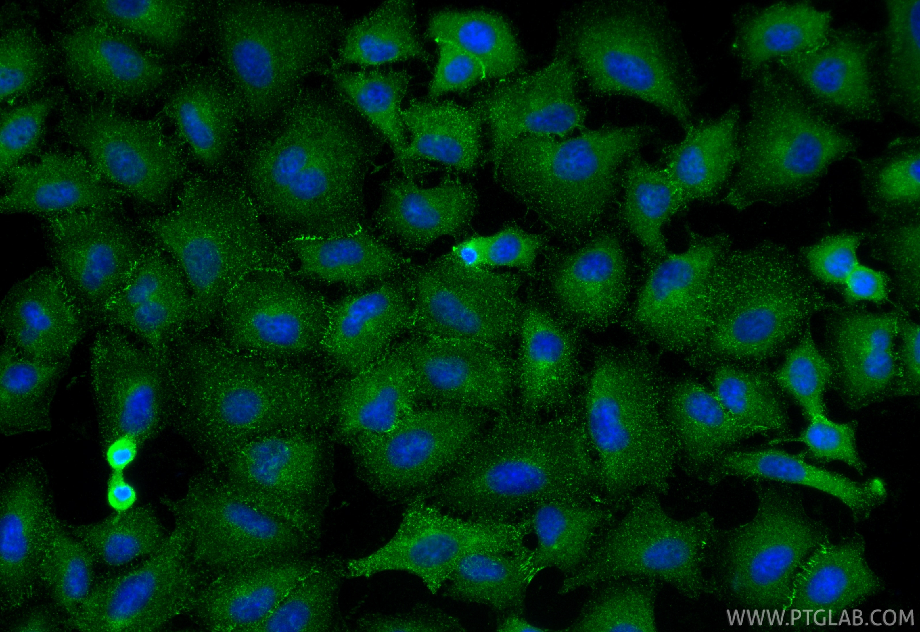 IF Staining of A549 using 27499-1-AP Immunofluorescence (IF) / fluorescent staining of A549 cells using SLC31A1 Polyclonal antibody (27499-1-AP)