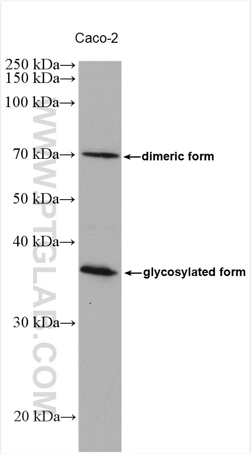 Western Blot (WB) analysis of various lysates using SLC31A1 Polyclonal antibody (27499-1-AP)