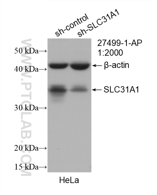 Western Blot (WB) analysis of HeLa cells using SLC31A1 Polyclonal antibody (27499-1-AP)