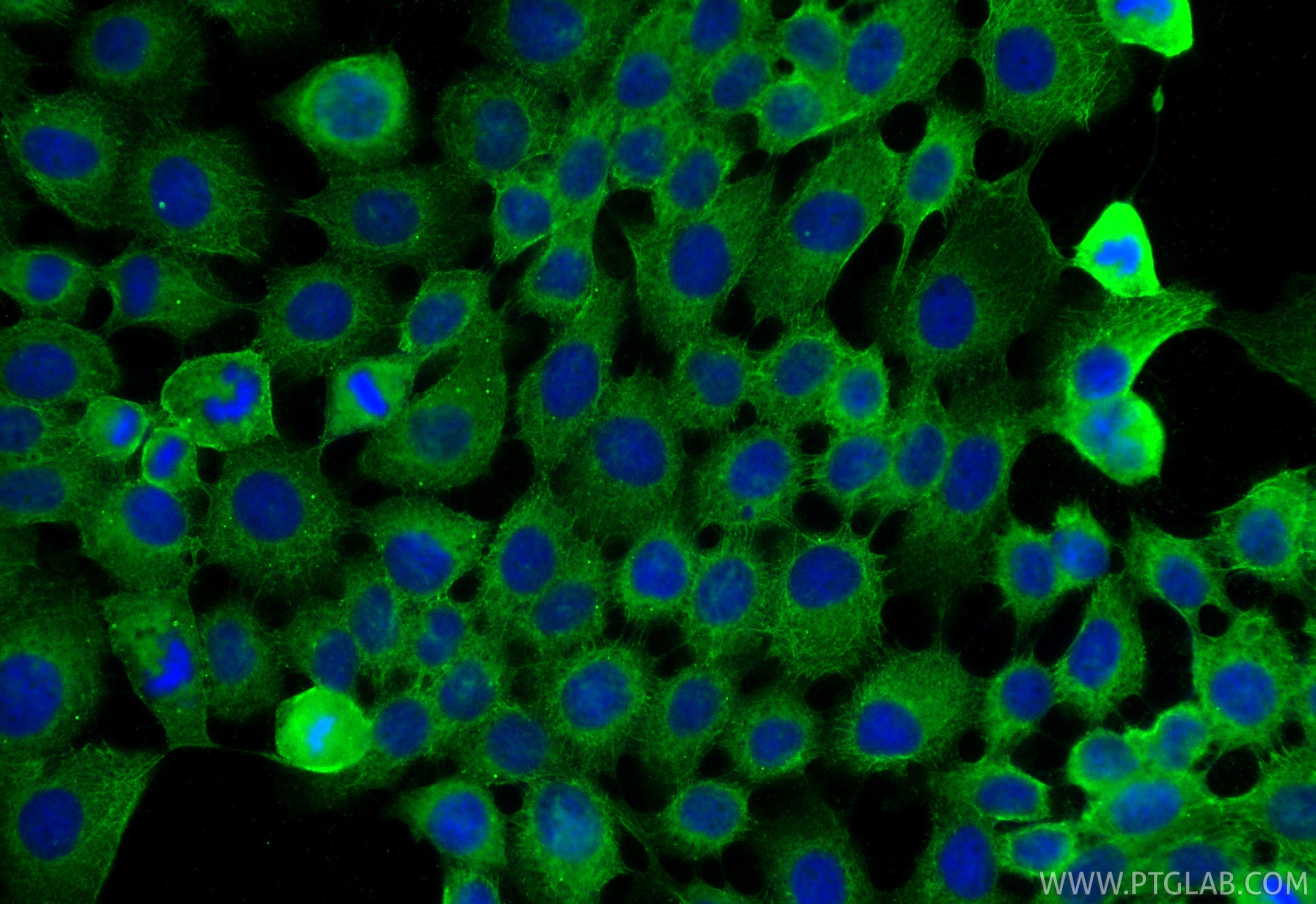 IF Staining of A431 using 67221-1-Ig Immunofluorescence (IF) / fluorescent staining of A431 cells using SLC31A1 Monoclonal antibody (67221-1-Ig)