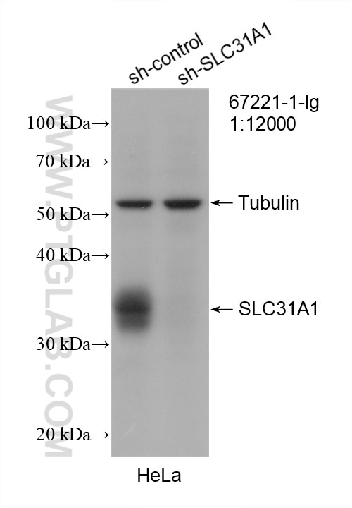 Western Blot (WB) analysis of HeLa cells using SLC31A1 Monoclonal antibody (67221-1-Ig)
