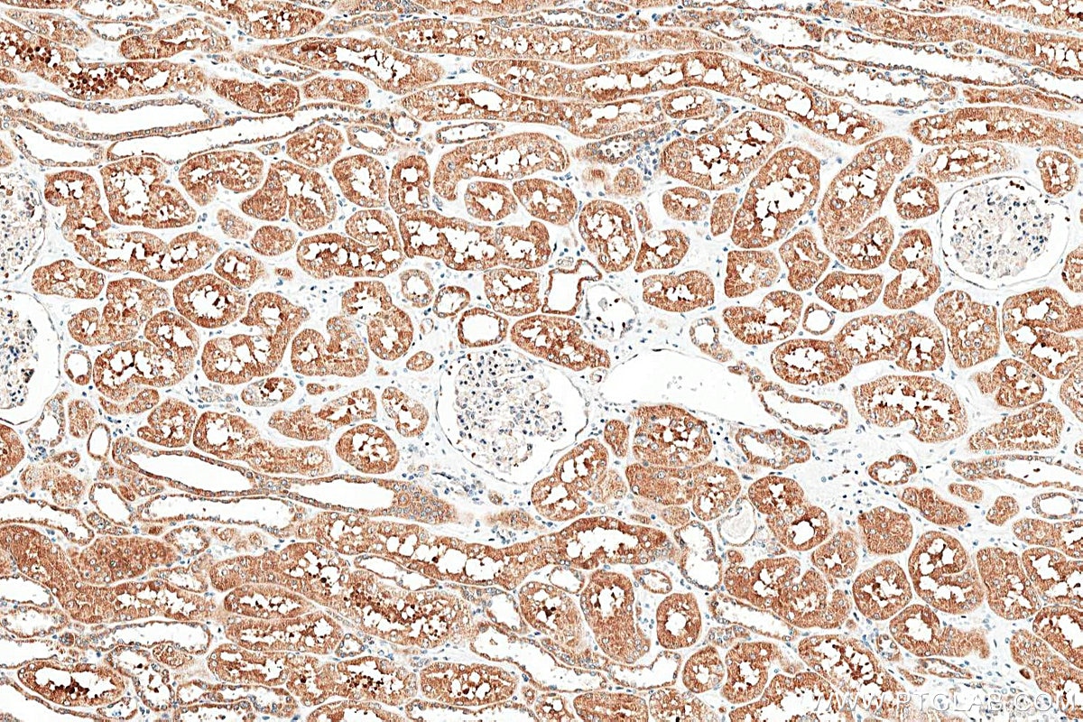 Immunohistochemistry (IHC) staining of human kidney tissue using SLC31A1 Recombinant monoclonal antibody (83844-5-RR)