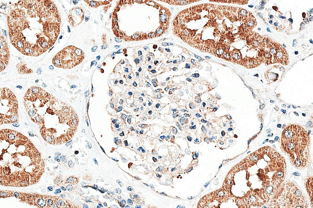 Immunohistochemistry (IHC) staining of human kidney tissue using SLC31A1 Recombinant monoclonal antibody (83844-5-RR)
