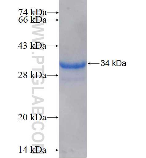 SLC31A1 fusion protein Ag26601 SDS-PAGE