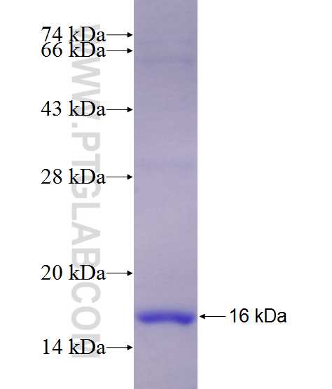 SLC31A1 fusion protein Ag28410 SDS-PAGE