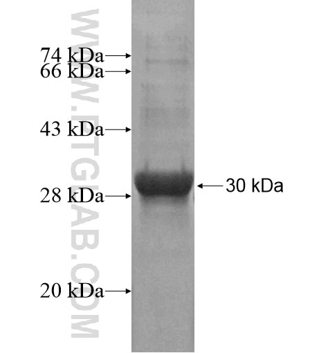 SLC31A2 fusion protein Ag14912 SDS-PAGE