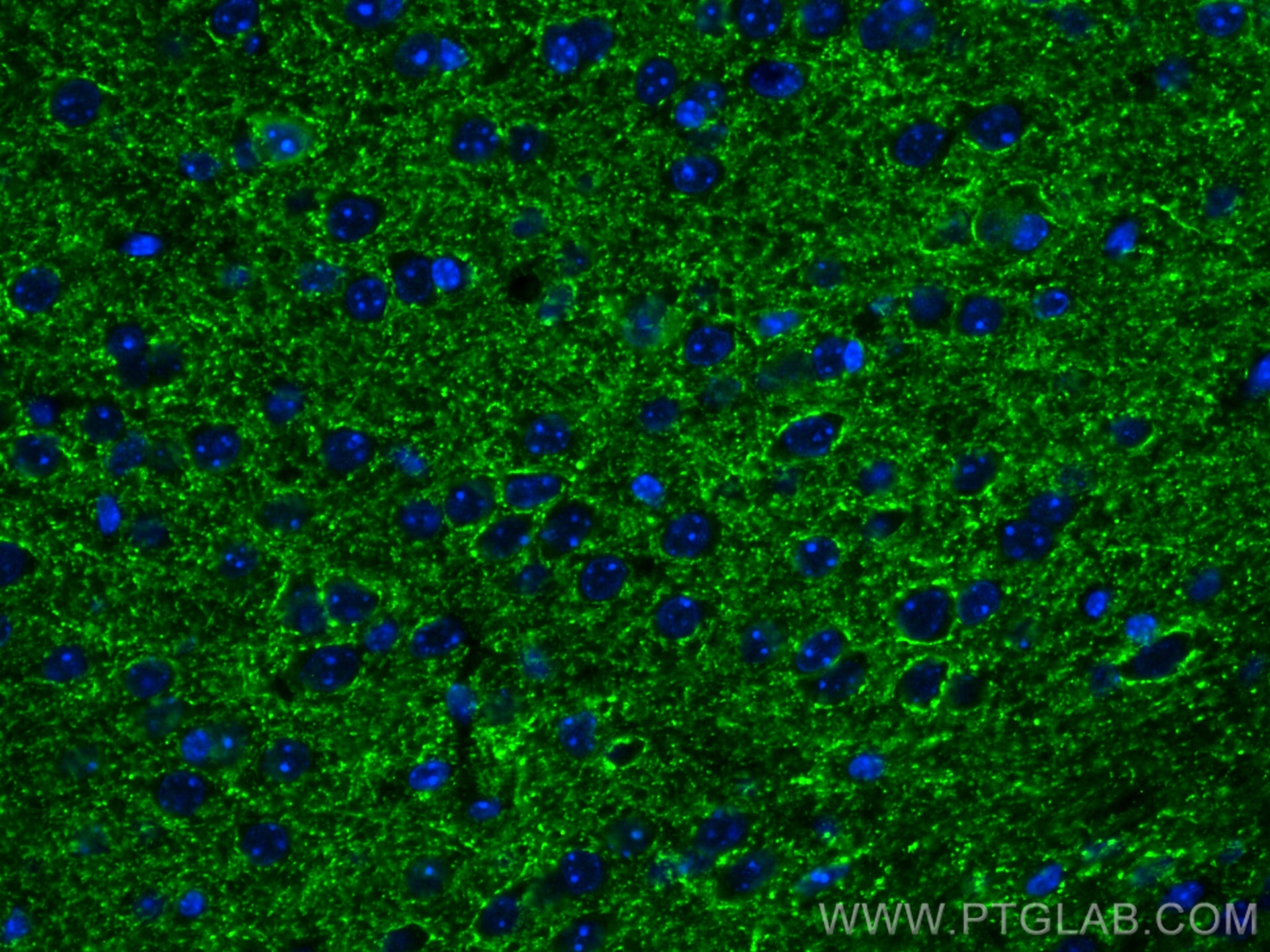 Immunofluorescence (IF) / fluorescent staining of mouse brain tissue using VGAT Polyclonal antibody (14471-1-AP)
