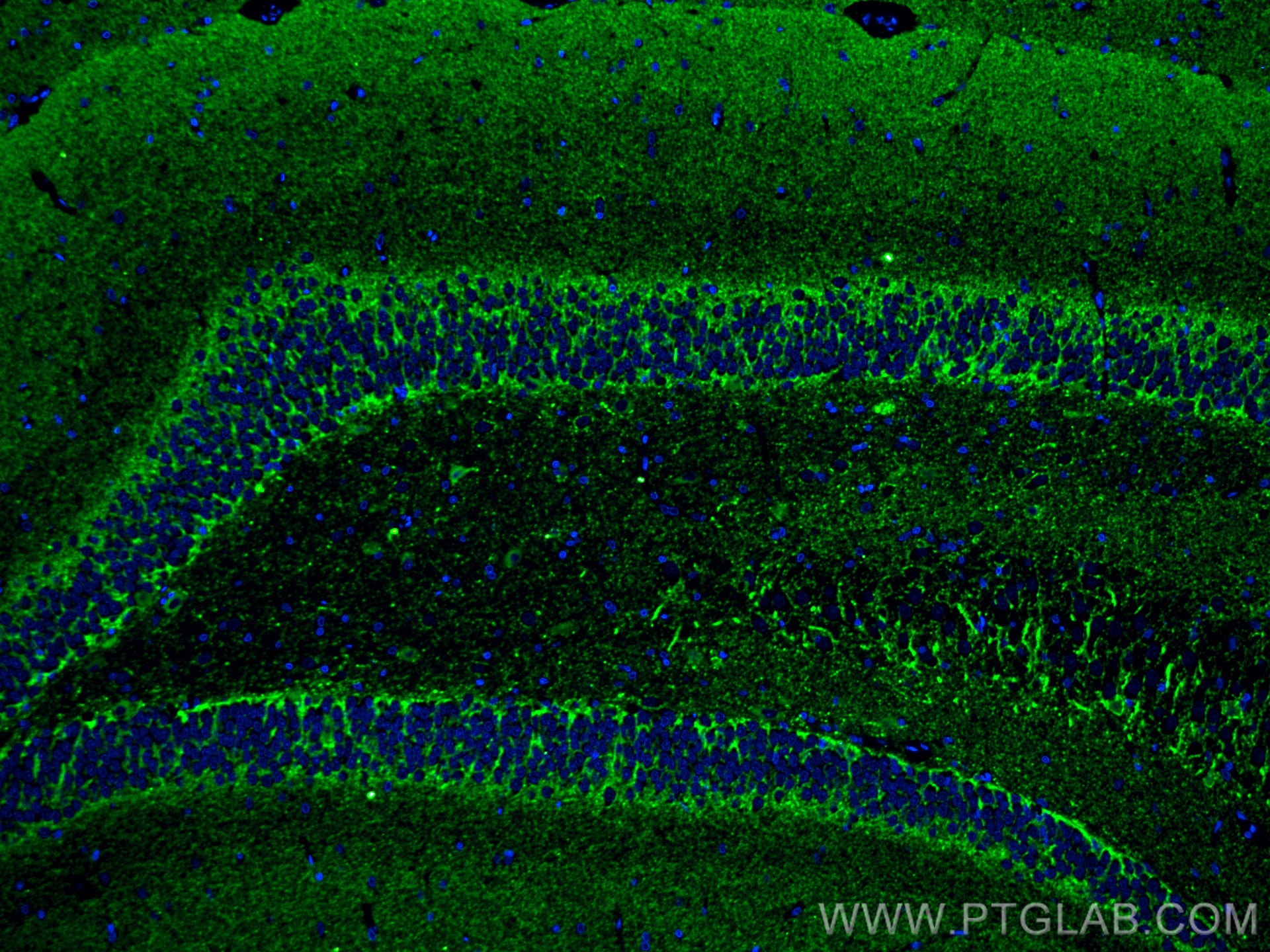 IF Staining of rat brain using 14471-1-AP