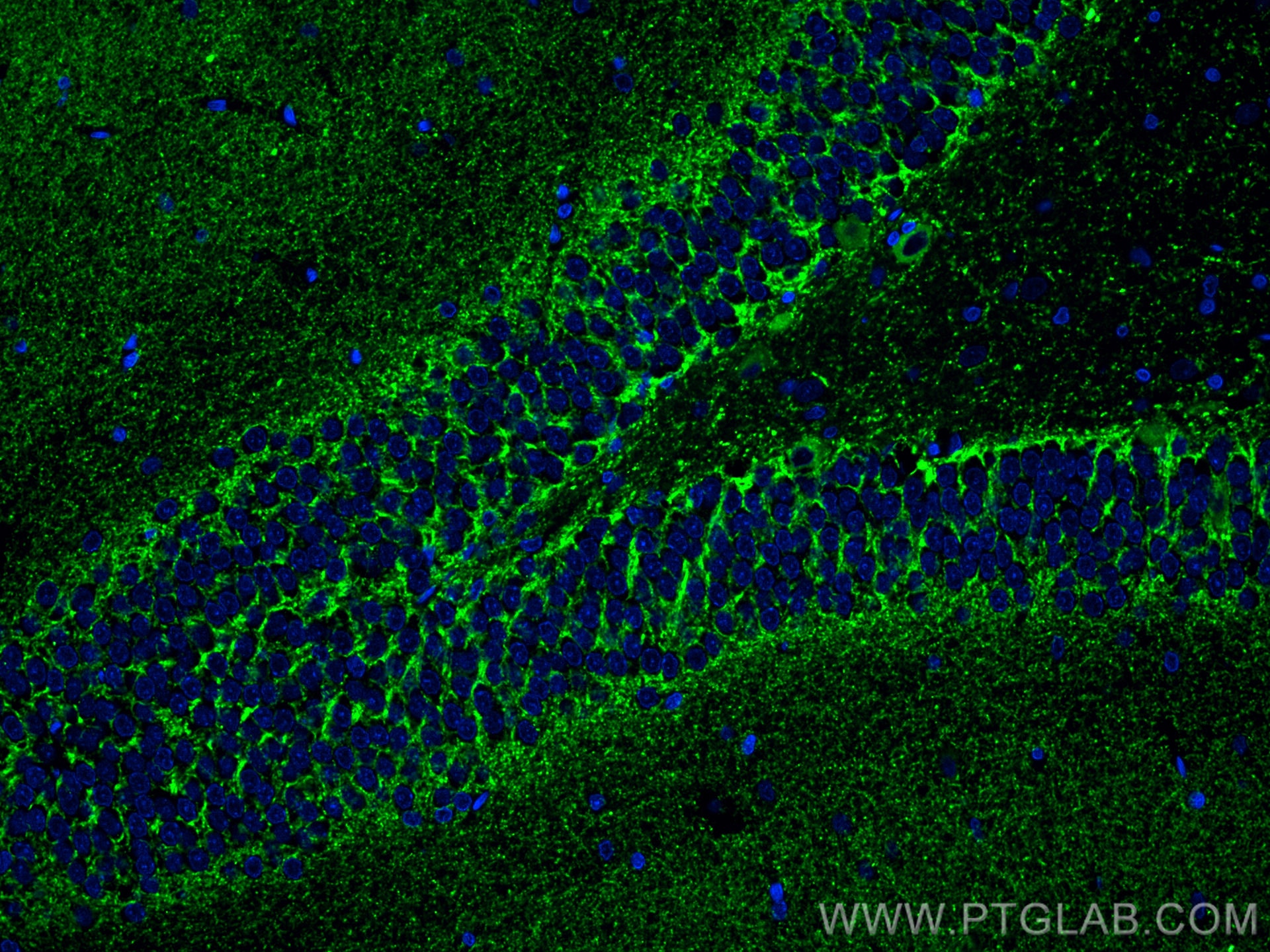 IF Staining of rat brain using 14471-1-AP