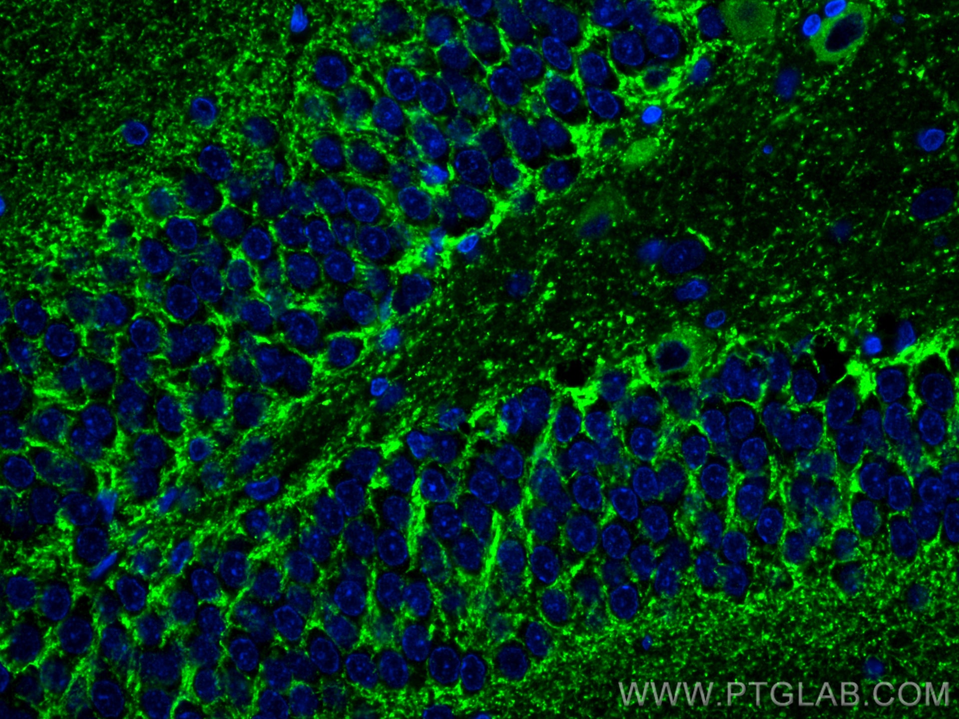 Immunofluorescence (IF) / fluorescent staining of rat brain tissue using VGAT Polyclonal antibody (14471-1-AP)