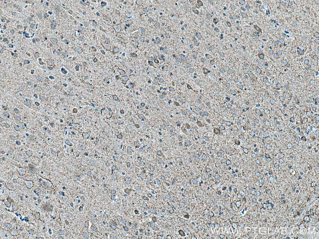 Immunohistochemistry (IHC) staining of rat brain tissue using VGAT Polyclonal antibody (14471-1-AP)