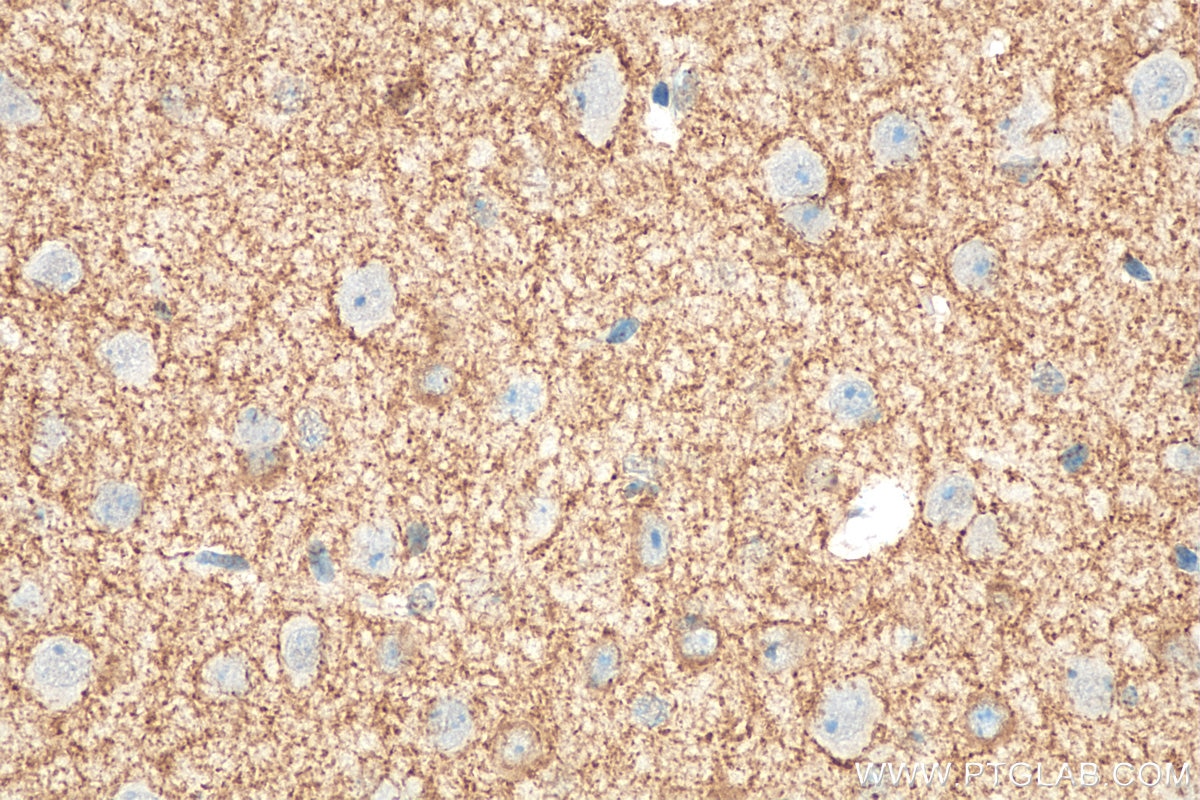 Immunohistochemistry (IHC) staining of mouse brain tissue using VGAT Polyclonal antibody (14471-1-AP)