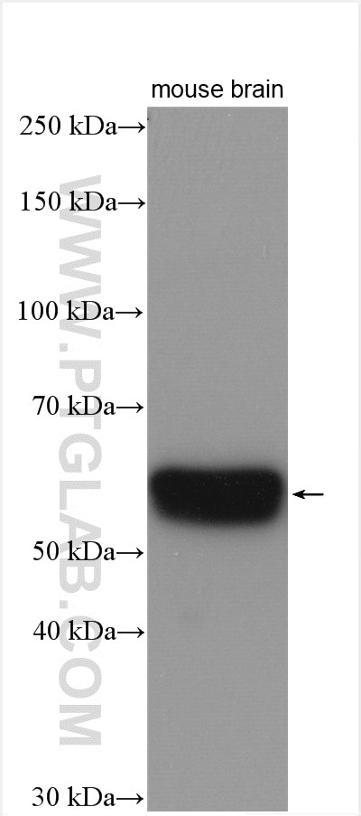 Western Blot (WB) analysis of mouse brain tissue using VGAT Polyclonal antibody (14471-1-AP)