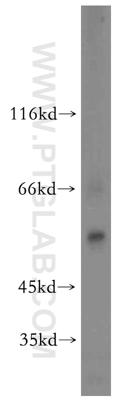 VGAT Polyclonal antibody